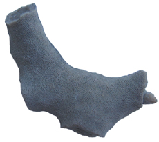 Bryozoan