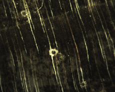 Pine Resin Canals