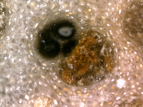 Palm Vascular Bundle