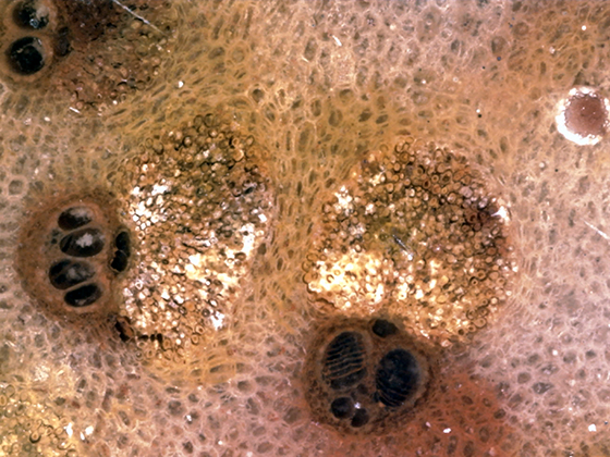 Scalariform Perforation Plates