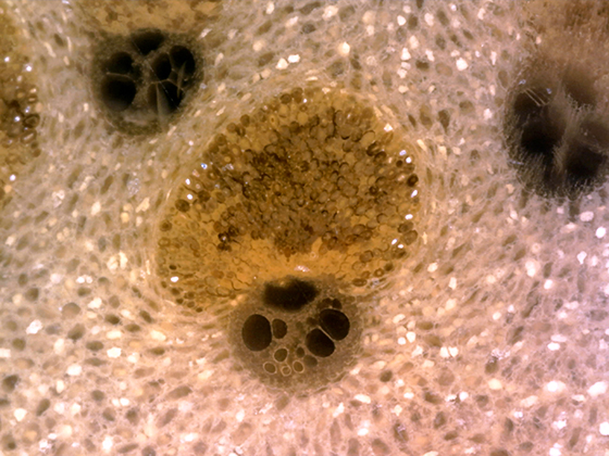 Vascular Bundle