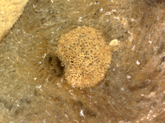 Vascular Bundle